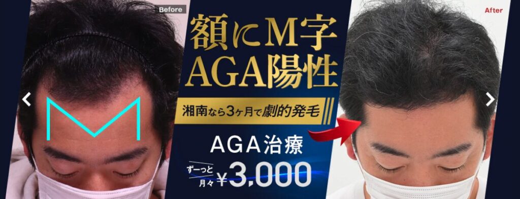湘南AGAクリニック